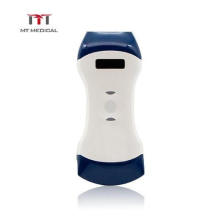 Double Head Linear Small Linear Micro Convex Portable Wireless Mobile Phone Ultrasound Scanner